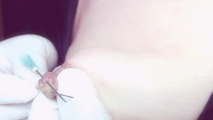 big nipple needle play2